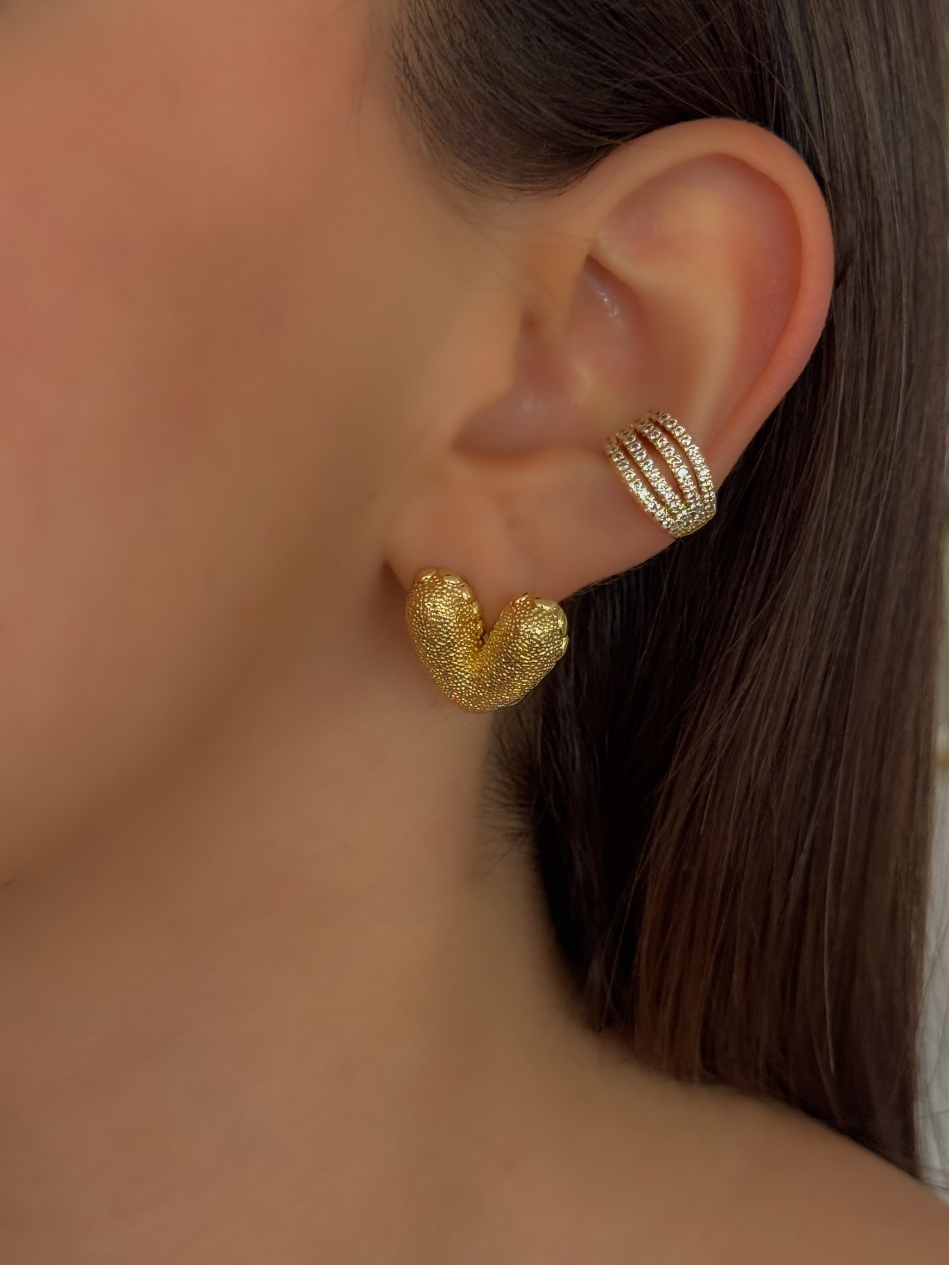 ARETE CORAZÓN 2